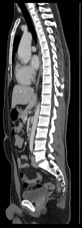 whole body CT image sideways